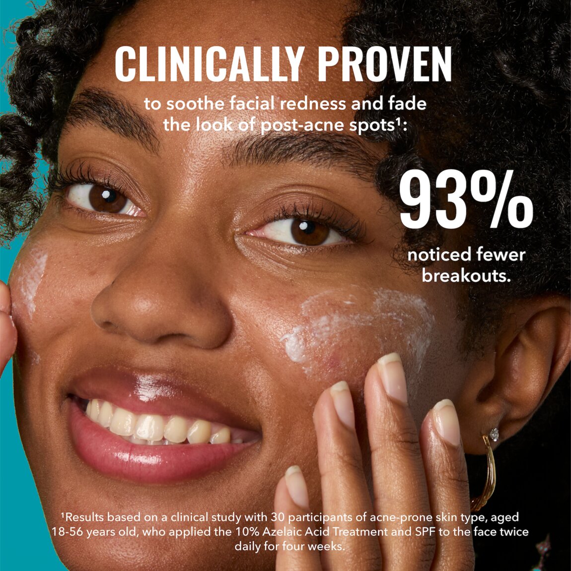 10-azelaic-acid-treatment-g9 zb_p.jpg