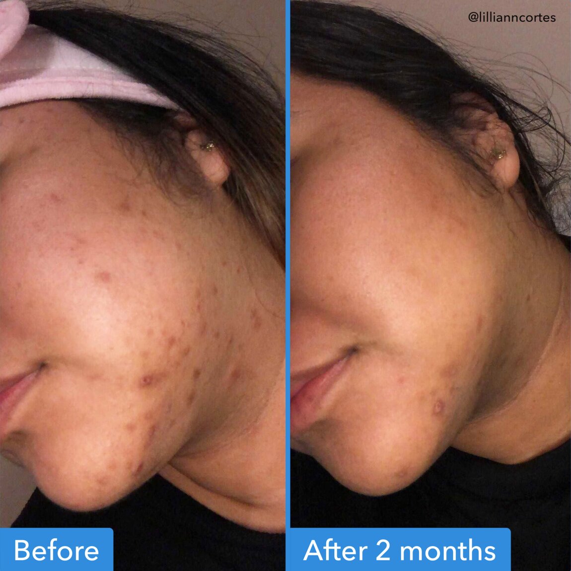 discoloration-correcting-serum-z6 zb_p.jpg