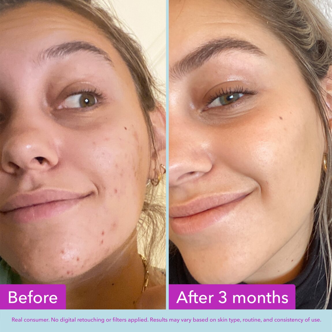 niacinamide-brightening-toner-x3 zb_p.jpg