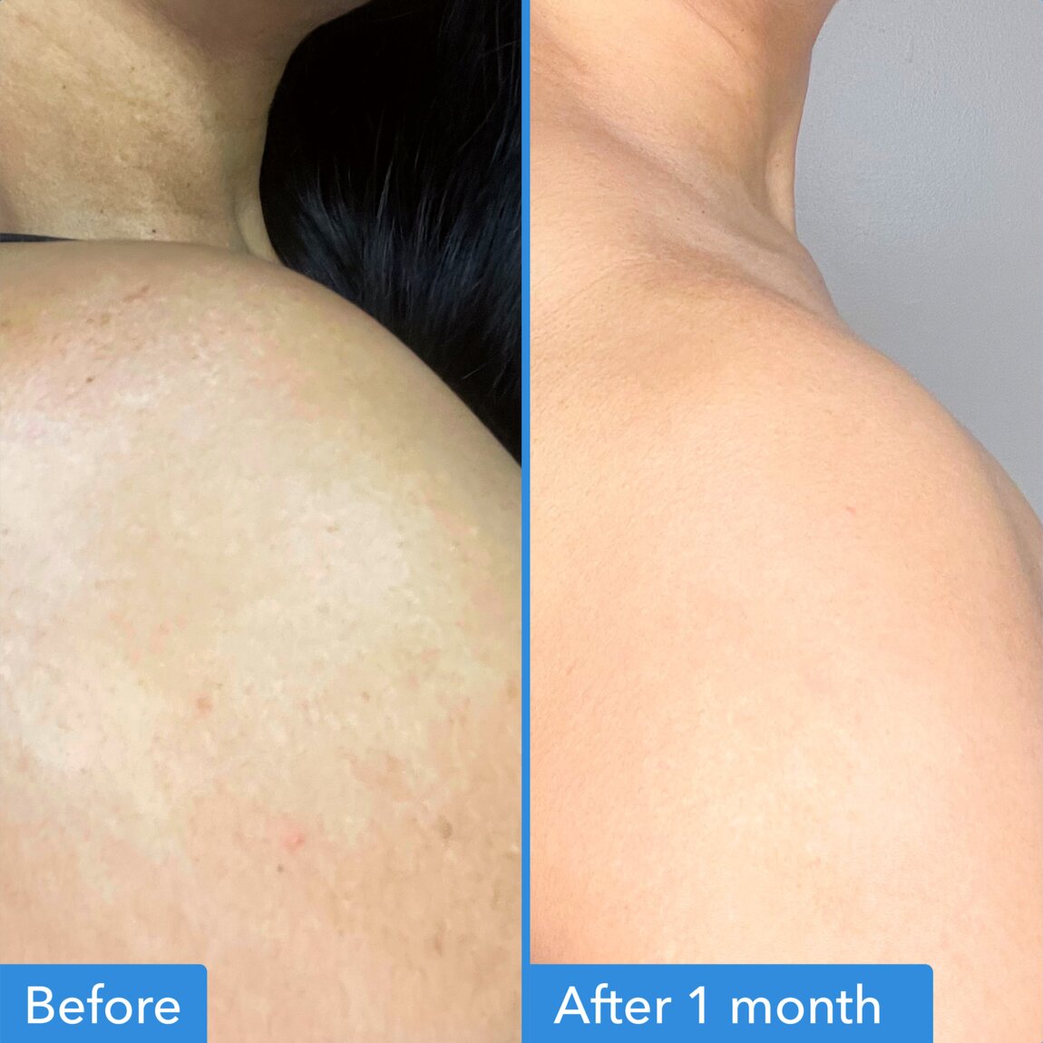 discoloration-correcting-body-treatment-z2 zb_p.jpg